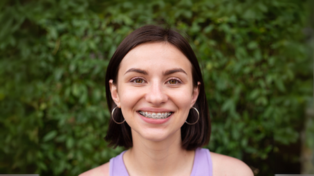 Dental Braces - An Ultimate Guide by an Orthodontist