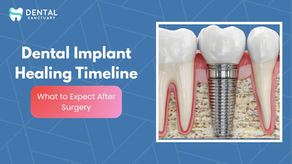 Dental Implant Healing Timeline – What to Expect After Surgery