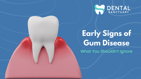Early Signs of Gum Disease – What You Shouldn’t Ignore