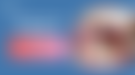 Tooth-Colored Crowns – Aesthetic Options for Front Teeth in Bangalore