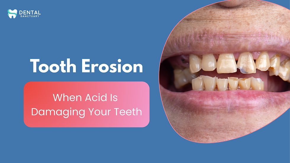 Tooth Erosion – When Acid Is Damaging Your Teeth