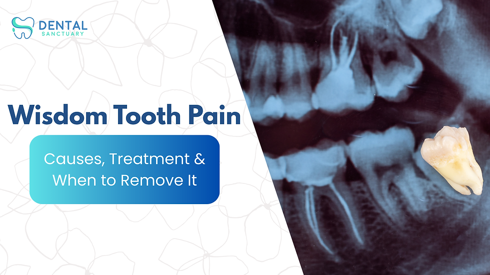Wisdom Tooth Pain in Bangalore – Causes, Treatment & When to Remove It