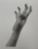 'Hypermobile Hand I'