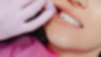 How Long Does a Deep Teeth Cleaning