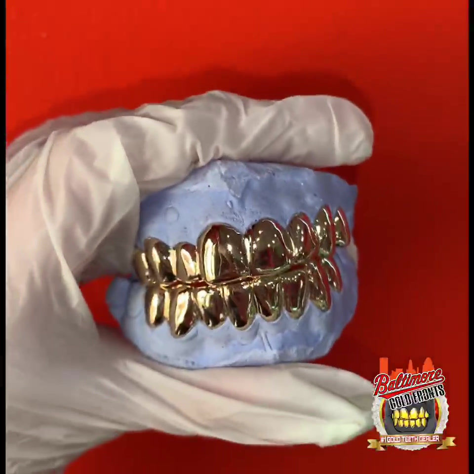 Fronts / Grillz Baltimore Gold Fronts United States 2/6