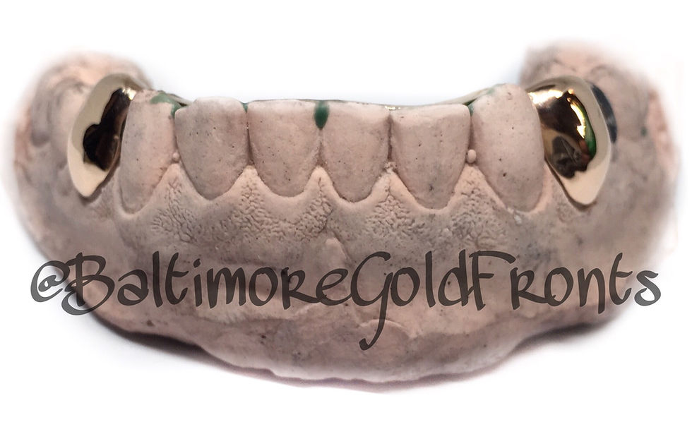 14k Gold 2 Solids w/ Back Bridge Gold