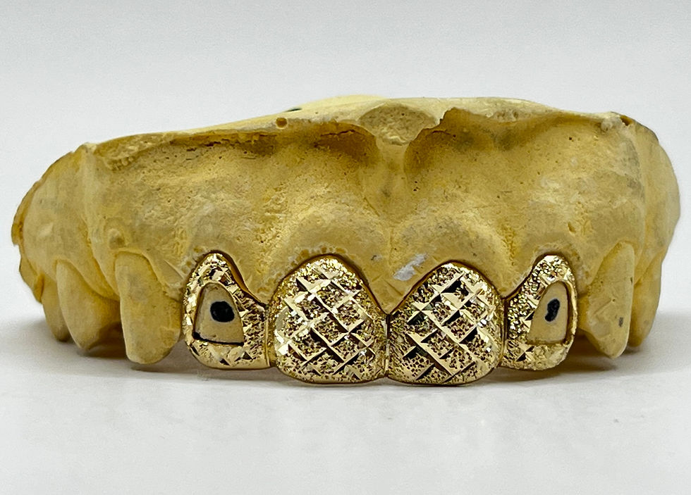 Fronts / Grillz Baltimore Gold Fronts United States