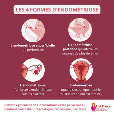 endométriose et naturopathie