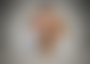 Vertigo: symptoms and treatment