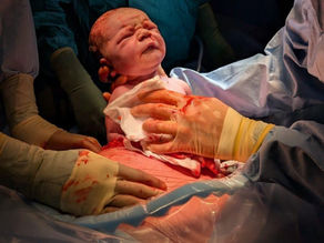 How to make a Caesarean Birth plan