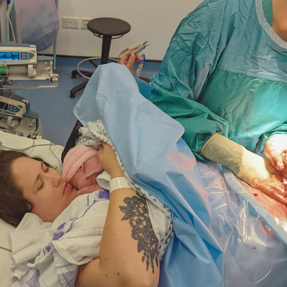 woman being stitched up after caesarean surgery