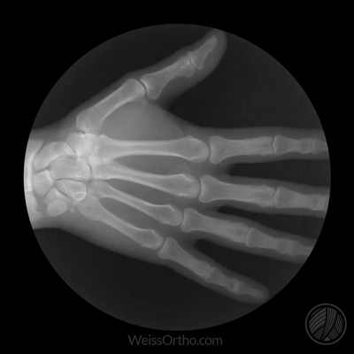 Ultron X rays cloud service