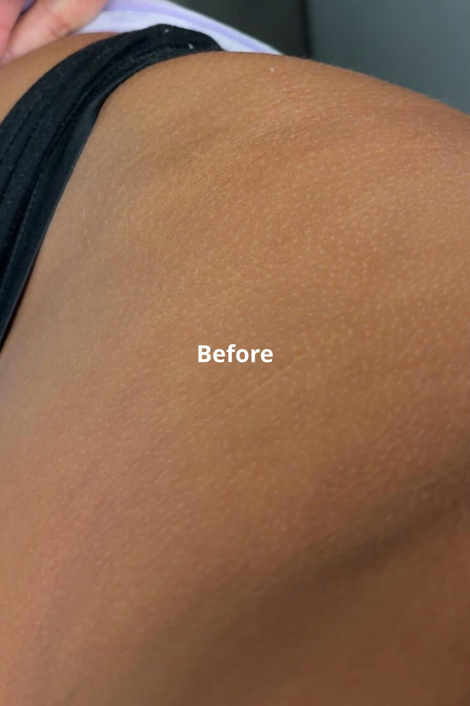 Thumbnail: Tingle sauce cream