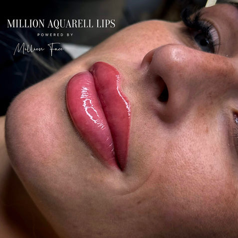 Lips von Million Face Aesthetic Studio