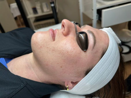 Client with acne