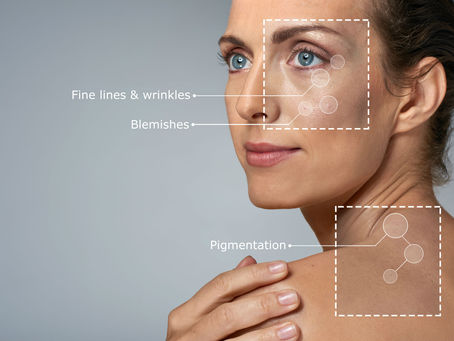 Understanding Skin Ageing: What Causes It and How You Can Slow It Down