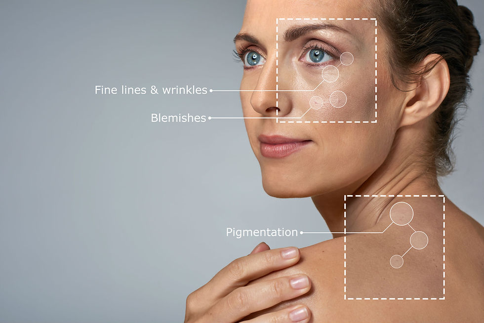 Woman's face and shoulder with highlighted boxes showing fine lines, wrinkles, blemishes, and pigmentation. Text on a gray background.