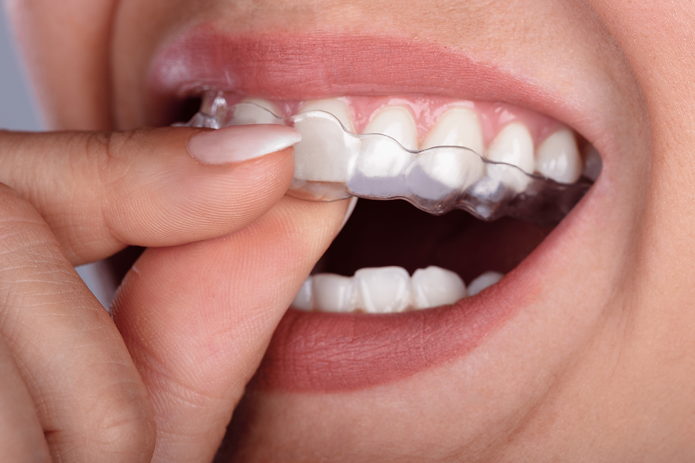 Clear-Correct-ALigners
