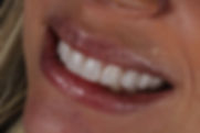 lente 1.jpg