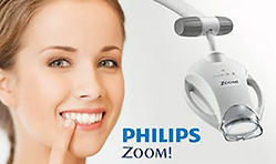 zoom-whitening-sno.jpg