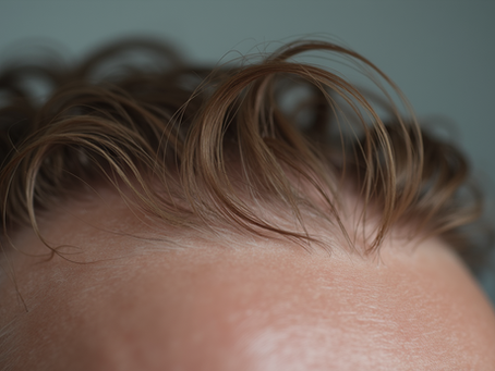 Effective Hair and Scalp Treatments