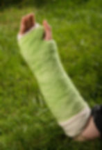 Broken arm
