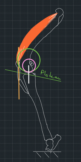 Figure 14. Due to luck, the patellar tendon was redirected do be parallel to the common normal we would have found if we had used the ball-in-bowl model.