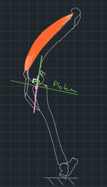 Figure 10. Green vector: Tibiofemoral force. Pink vector: Reaction force from the tibia.