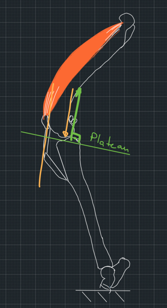 Figure 5. If we direct the patellar tendon to be perpendicular to the tibial plateau, the system will be in equilibrium.