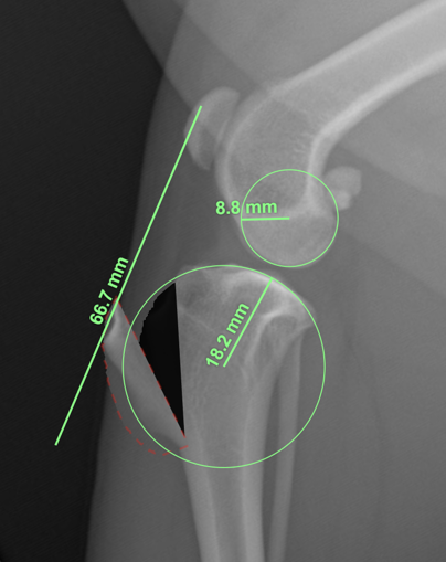 Figure 16. We can't accurately draw the best fit of the contact surfaces using a radiograph.