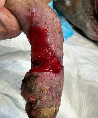 AFTER REMOVAL AND SKIN GRAFT