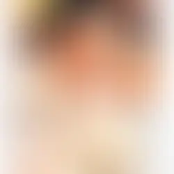 ISM: Radical Liberalism and Liberal Radicalism