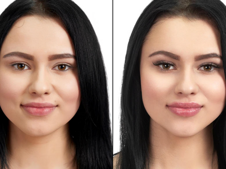 before and after face slimming treatment