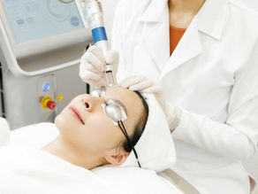 Pico Laser Before and After: Realistic Results for Dark Skin