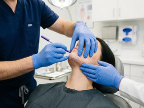 Top 3 Non-Surgical Double Chin Treatments in KL | Ava Clinic