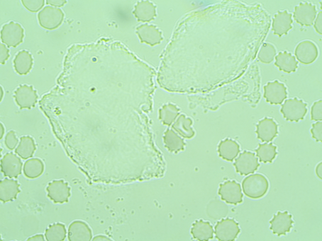 Too True For FB by Ian Jacklin 3/29/22