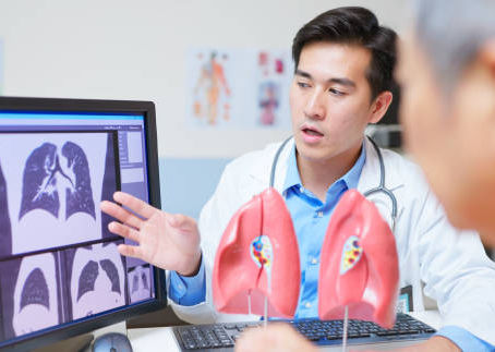 A doctor explains lung X-rays to a patient in a clinic. Lung model on desk, screen shows scans. Doctor looks focused and serious.