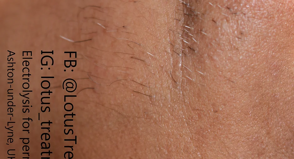 Home Lotus Treatment Parlour Hair Removal Service