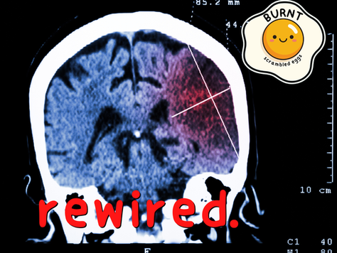 Rewired