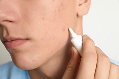 Benzac Singapore: Your Guide to Anti-Acne and Pimple Gel Cream