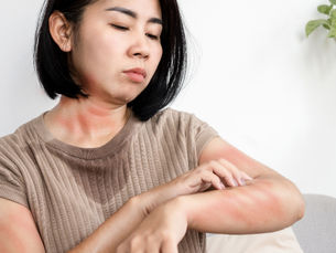 中醫師教你：迎戰轉季濕疹！內外調理全攻略 