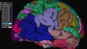 SEEG-Cortical-Parcellation-Interface.jpg