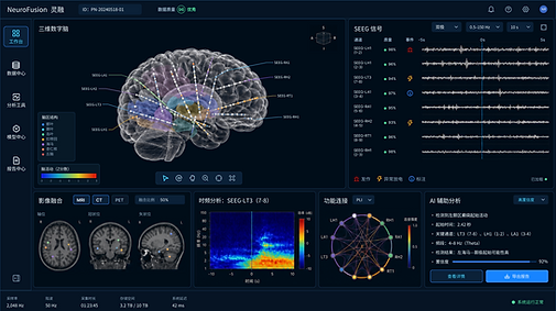 NeuroFusion multimodal brain visualization — illustrative product interface