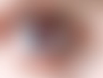Com Fotografias Da Retina e IA, Cientistas Detectam Alterações Associadas ao Alzheimer