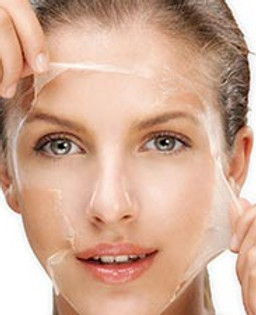 Doctora-Blanco-Medicina-Estetica-Barcelona-Peeling-Quimico.jpg