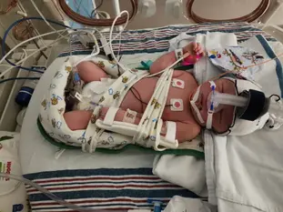 Hanover Mom Reflects on Life-Saving Care at UPMC Magee-Womens as Son Turns One