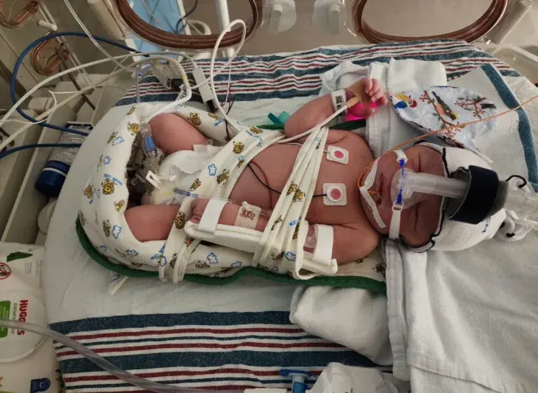 Hanover Mom Reflects on Life-Saving Care at UPMC Magee-Womens as Son Turns One