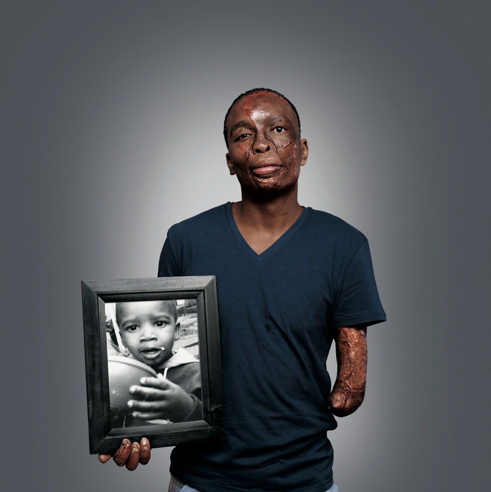 Bongani