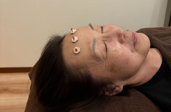 仰向けになって、おでこに台座灸をしている