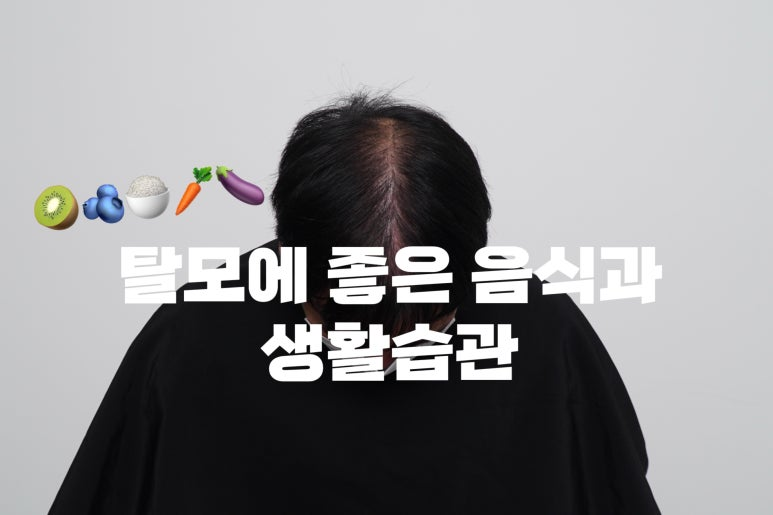 탈모에 좋은 음식과 생활습관